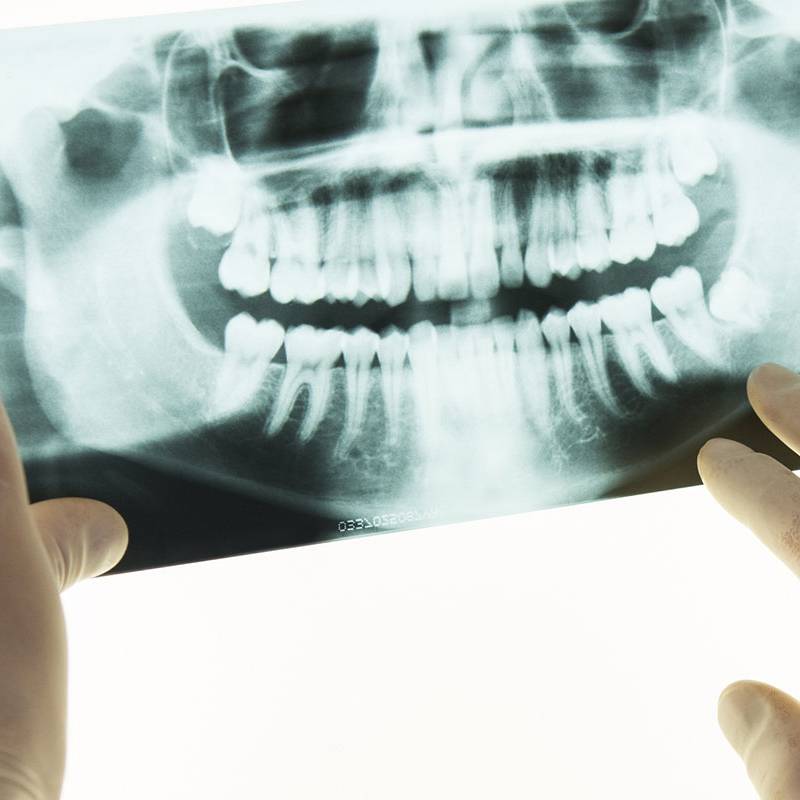 Orthodontie phases traitement